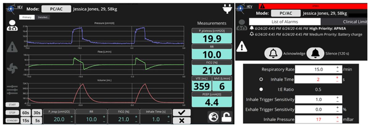 Exploring the Frontier of System Trading Innovations